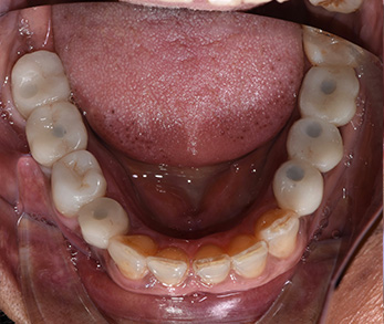 Amityville Emergency Dentist