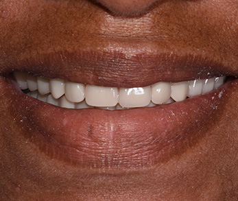 Family Dentist in Amityville