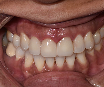 Pediatric Dentist near Amityville