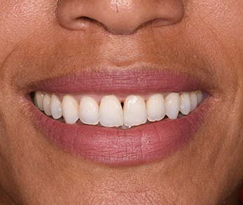 Amityville Cosmetic Dentist