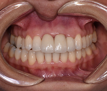 Amityville Cosmetic Dentist