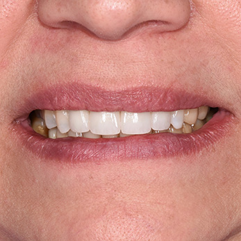 Amity Harbor Dentistry | Cosmetic Dentistry, Dental Cleanings and Root Canals