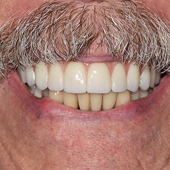 Amity Harbor Dentistry | Digital Radiography, Dental Fillings and TMJ Disorders