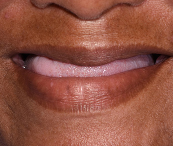 Cosmetic Dental Office Amityville