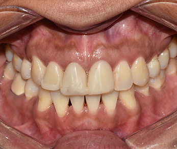 Dentist in Amityville