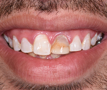 Dentist in Amityville