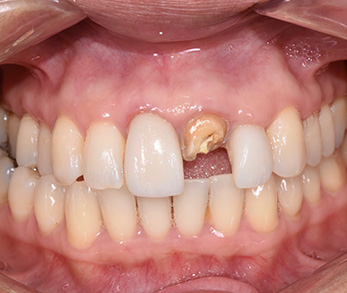 Cosmetic Dental Office Amityville