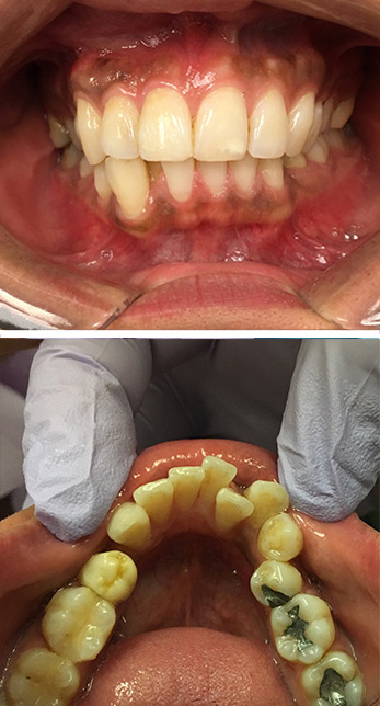 Amityville Emergency Dentist