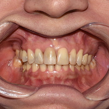 Amity Harbor Dentistry | TMJ Disorders, Cosmetic Dentistry and Emergency Treatment