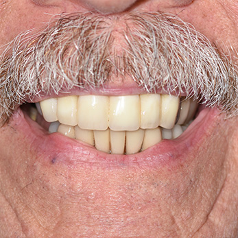 Amity Harbor Dentistry | Digital Radiography, Dentures and Dental Fillings